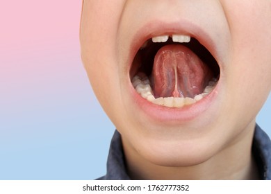 boy, kid performs articulation exercises for mouth, concept of speech disorders, correction, frenum of tongue, methods of correctional developmental exercises