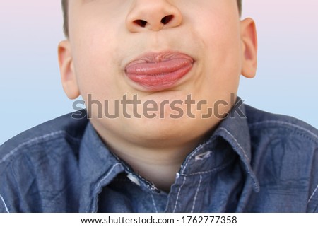boy, kid performs articulation exercises for mouth, concept of speech disorders, correction, frenum of tongue, methods of correctional developmental exercises