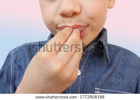 boy, kid performs articulation exercises for mouth, concept of speech disorders, correction, frenum of tongue, methods of correctional developmental exercises