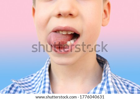 boy, kid performs articulation exercises for mouth, concept of speech disorders, correction, frenum of tongue, methods of correctional developmental exercises