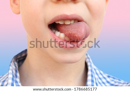 boy, kid performs articulation exercises for mouth, concept of speech disorders, correction, frenum of tongue, methods of correctional developmental exercises