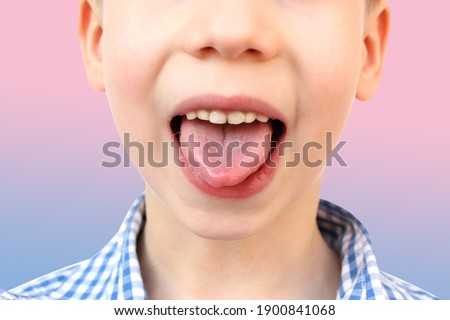 boy, kid performs articulation exercises for mouth, concept of speech disorders, correction, frenum of tongue, methods of correctional development