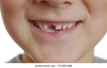 The boy mouth without a tooth. Baby teeth. Changing teeth. Oral care. Closeup