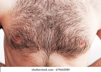 Hairypics