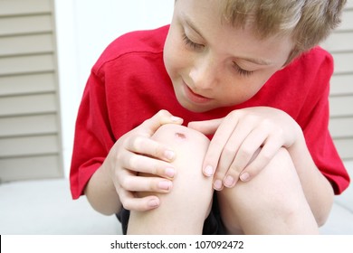 Boy With A Scraped Knee