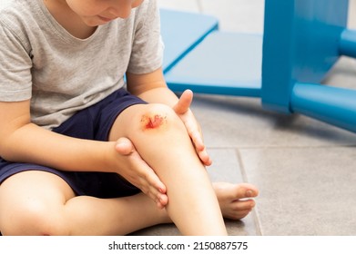 Boy with a scraped knee