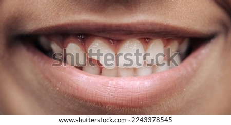 A boy smiling with a broken teeth in front 