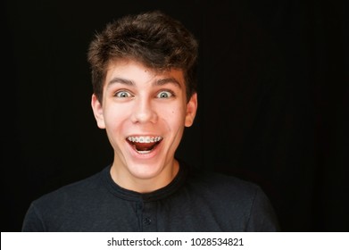 A Boy Of Teenage Age Laughing On A Black Background. On Teeth, He Has Braces For Leveling Teeth. The Braces Are Clearly Visible On The Upper And Lower Jaw