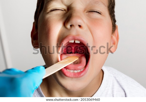 The boy\'s mouth is wide open with tonsils are\
enlarged, visible in the white or yellowish tinge on a gray\
background. Pediatrician checking 8-aged schoolboy\'s throat\
applying wooden spatula.