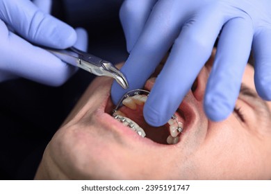 Braces on the teeth. Close-up of a dentist's hand with a tool. Correction of braces. Orthodontic fixed structures. - Shutterstock ID 2395191747