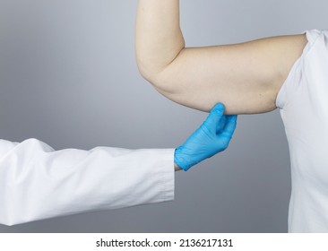 Brachioplasty. Plastic arms, dangling skin at the elbow. An older woman shows the surgeon problem areas of the forearm. Examination before cosmetic surgery - Shutterstock ID 2136217131