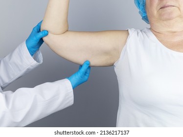 Brachioplasty. Plastic arms, dangling skin at the elbow. An older woman shows the surgeon problem areas of the forearm. Examination before cosmetic surgery - Shutterstock ID 2136217137