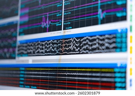 Brain activity data viz. Complex brain activity data displayed on multiple screens, showcasing different types of neural signals in real-time.