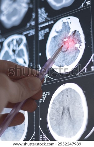 Brain computed tomography (CT) scan of a patient. Learning head diseases. Vertical image.