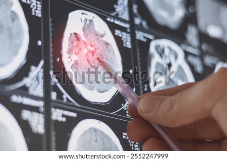 Brain computed tomography (CT) scan of a patient. Learning head diseases.