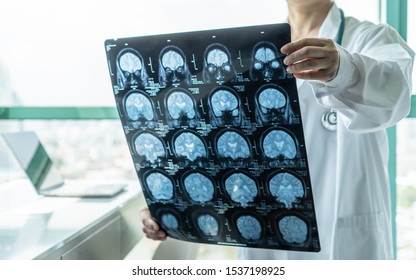 Brain disease diagnosis with medical doctor seeing Magnetic Resonance Imaging (MRI) film diagnosing elderly ageing patient neurodegenerative illness problem for neurological medical treatment