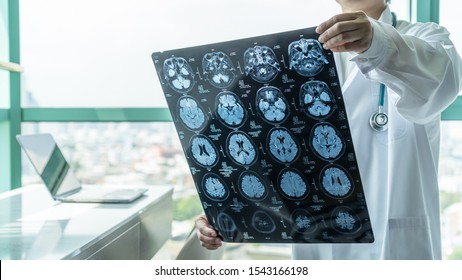 Brain disease diagnosis with medical doctor seeing Magnetic Resonance Imaging (MRI) film diagnosing elderly ageing patient neurodegenerative illness problem for neurological medical treatment
