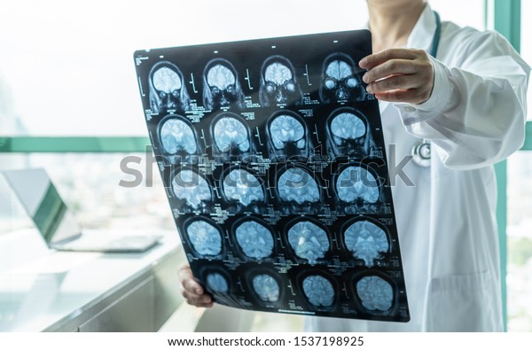 Brain disease diagnosis with medical doctor\
seeing Magnetic Resonance Imaging (MRI) film diagnosing elderly\
ageing patient neurodegenerative illness problem for neurological\
medical treatment