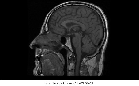 Brain Mri Scan High Resolution Head Stock Photo 1370379743 | Shutterstock