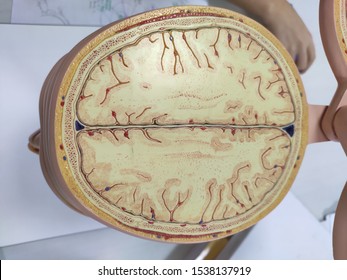 brain sample in anatomy laboratory.