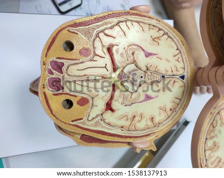 brain sample in anatomy laboratory.