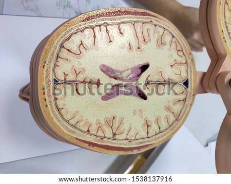 brain sample in anatomy laboratory.