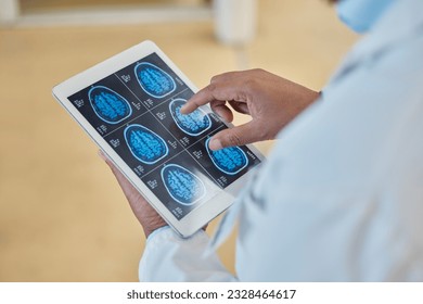 Brain scan, xray and closeup of a doctor with a tablet for a neurology consultation or surgery. Healthcare, digital technology and hands of surgeon analyzing a mri image in medical hospital or clinic - Powered by Shutterstock