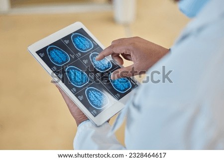 Brain scan, xray and closeup of a doctor with a tablet for a neurology consultation or surgery. Healthcare, digital technology and hands of surgeon analyzing a mri image in medical hospital or clinic