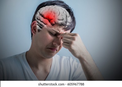 Brain Stroke Concept, Headache, Cerebral Hemorrhage, 3D Rendering