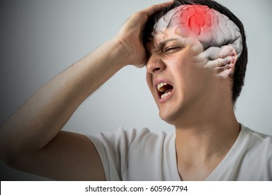 brain stroke concept, headache, cerebral hemorrhage, 3D rendering - Shutterstock ID 605967794