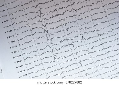 Brain Wave On Electroencephalogram Eeg Wave Stock Photo 378229882 ...