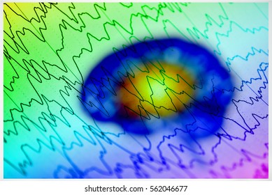 Brain Wave On Electroencephalogram EEG For Epilepsy