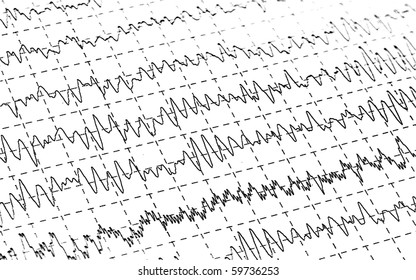 Brain Waves On Encephalogramme EEG (white Background)