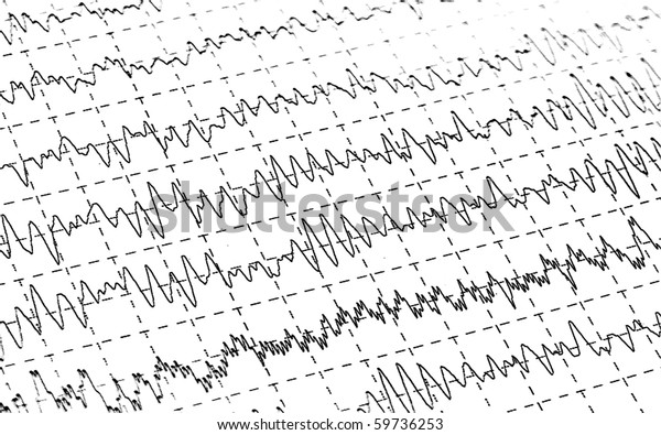 eeg brain waves