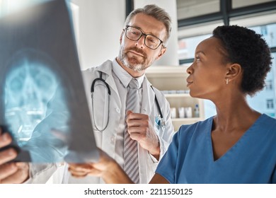 Brain, x ray and neurology doctors in a meeting working on a skull injury in emergency room in a hospital. Diversity, cancer and healthcare medical neurologist checking mri or xray scan with teamwork