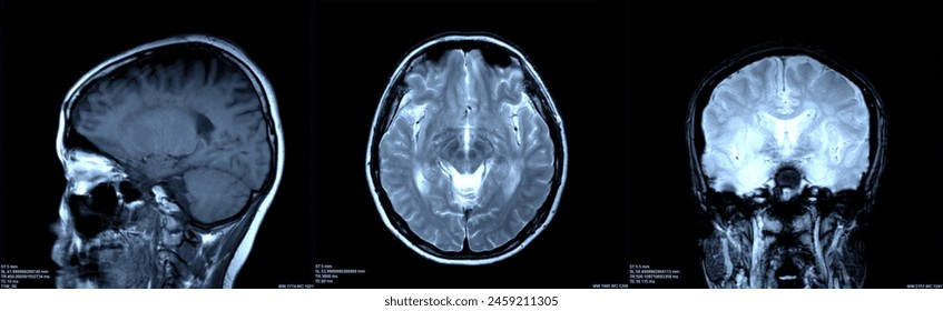 Brain x-ray images scan by mri or ct scan. radiology or radiograph concept. - Powered by Shutterstock