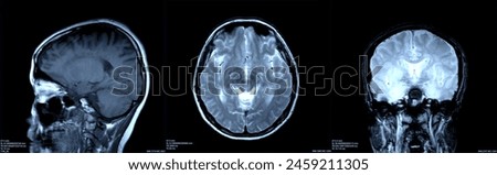 Brain x-ray images scan by mri or ct scan. radiology or radiograph concept.