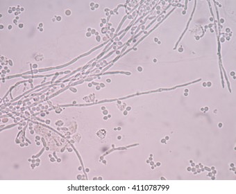 Branching Budding Yeast Cells Pseudohyphae Urine Stock Photo 411078799 ...