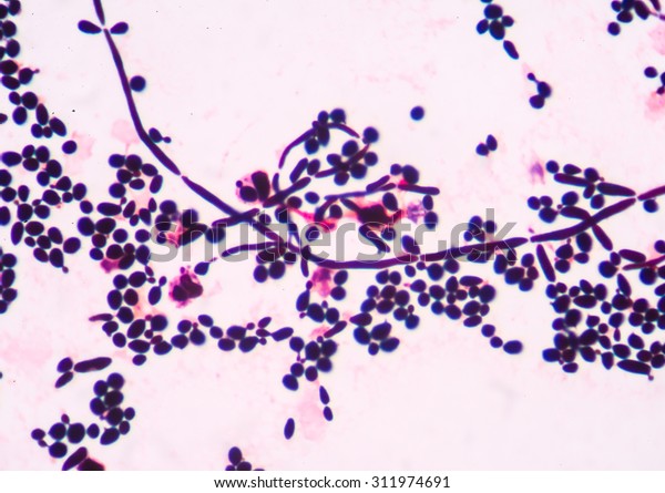 Branching Budding Yeast Cells Pseudohyphae Urine Stock Photo 311974691 ...