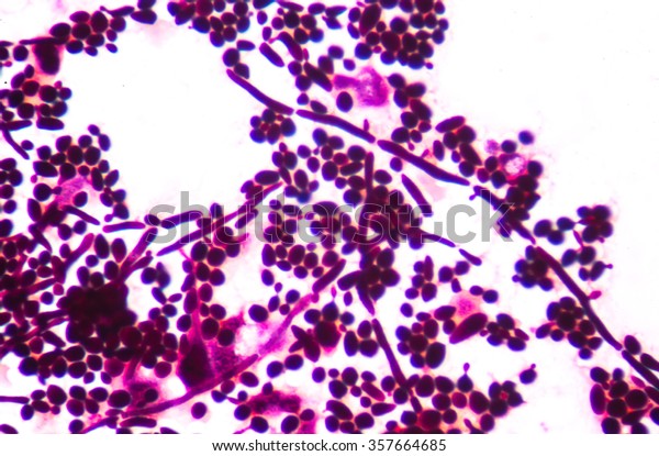 Branching Budding Yeast Cells Pseudohyphae Urine Stock Photo 357664685 