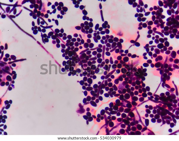 Branching Budding Yeast Cells Pseudohyphae Gram Stock Photo (Edit Now ...