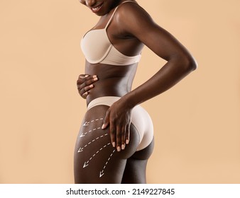 Brazilian butt lift concept. Young black lady in beige underwear touching her beautiful buttocks with white marks on it, dreaming about contouring plastic surgery, studio background, cropped, collage