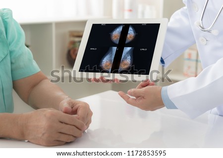 breast cancer concept. doctor explain mammogram results of breast test from x-ray scan on digital tablet screen to patient.