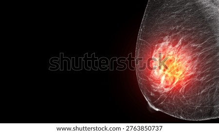 Breast Cancer Concept Mammogram with Glowing Red Tumor HighlightDescription: Conceptual mammogram with a glowing red highlight indicating a breast tumor, cancer, or severe inflammation. Highly effective for oncology and breast cancer awareness campaigns.
