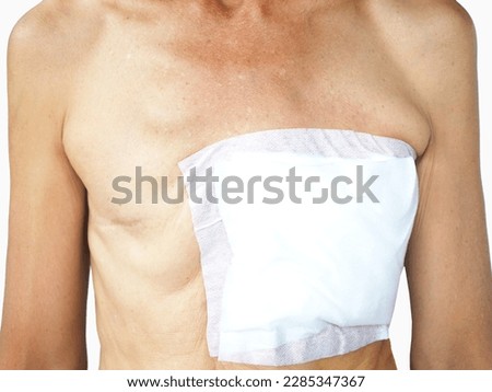 Breast cancer surgery by removing both breast.