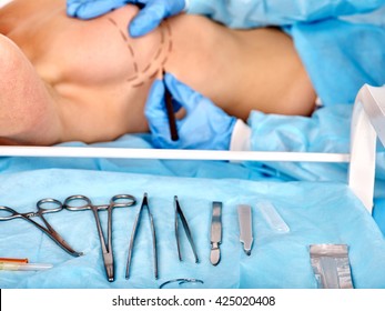 Breast Cancer Surgery. Doctor Makes Dotted Line On Female Body. Surgical Instruments On Foreground.