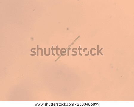 Brightfield DIC micrograph of Synedra acus diatom at 100x
