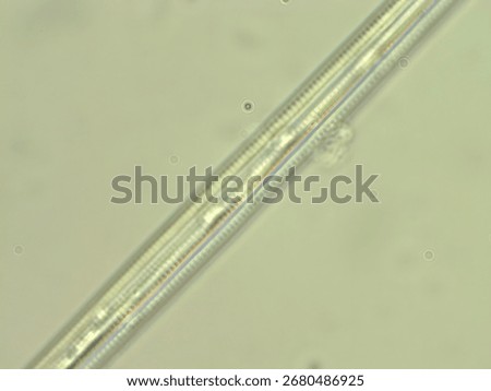 Brightfield DIC micrograph of Synedra acus diatom at 1000x