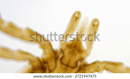 Brightfield light micrograph of the tick Ixodes ricinus, showing the anterior body and mouthparts at 100x magnification, imaged with an Olympus BH2 microscope.