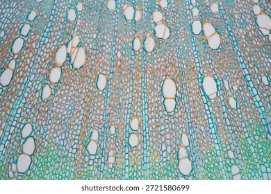 Brightfield micrograph of a root cross section of the Soybean (Glycine max)  at 100x magnification, stained with Astra Blue, Acridine Red, and Acriflavine. The image highlights the xylem vessels (trachea). Captured with an Olympus Vanox AHBT3 microscope